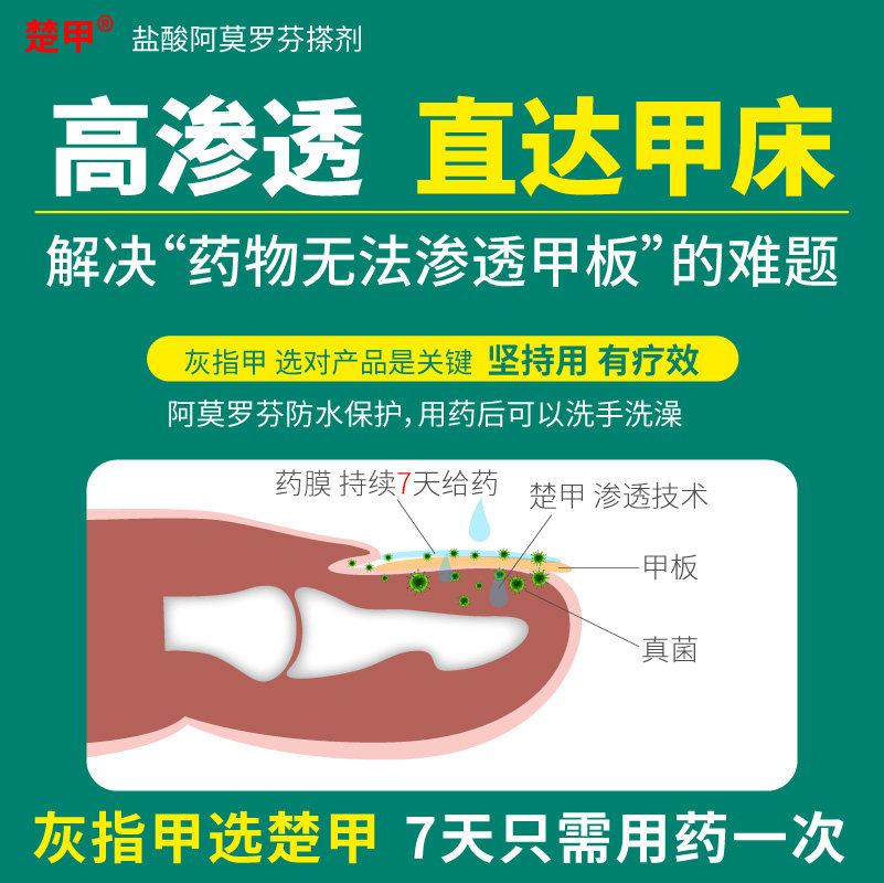 楚甲盐酸阿莫罗芬搽剂正品专用药 阿里健康大药房癣症