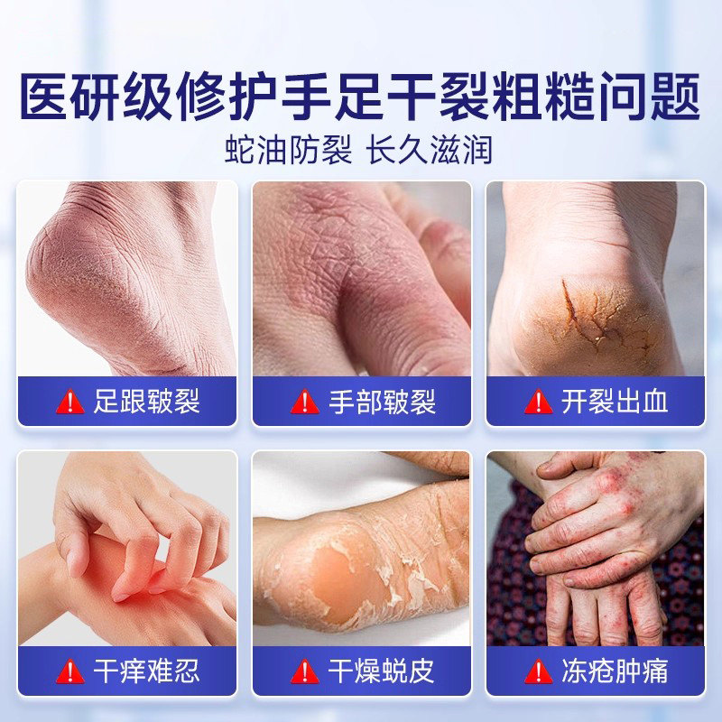 葵花蛇油膏手足脚干裂开裂手足皲裂膏皮肤冬季润肤保湿霜护手霜,淘宝优惠券,粉丝福利购,淘宝优惠卷