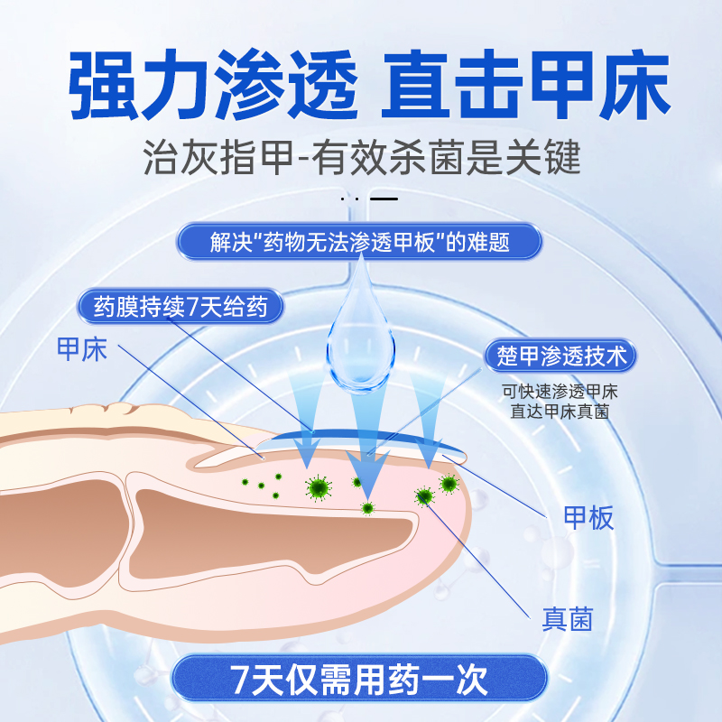 楚甲盐酸阿莫罗芬搽剂灰指甲正品专用药旗舰店脚气甲癣甲增厚官方 - 图3