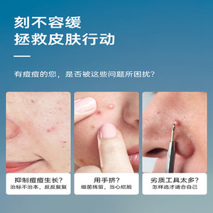 拉美拉超细粉刺针细胞夹套装镊子去黑头刮闭口神器挑挤痘祛痘针