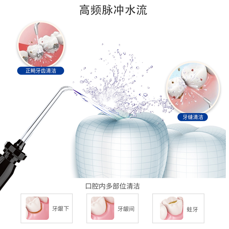 德国碧乐士冲牙器家用洗牙器脉冲水牙线牙结石牙齿正畸口腔清洁器-图1