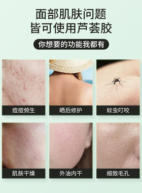 碧素堂芦荟胶正品官方旗舰