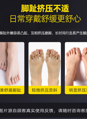 硅胶分趾器可穿鞋大拇指外翻大脚骨分离女士大母脚趾矫正器儿童