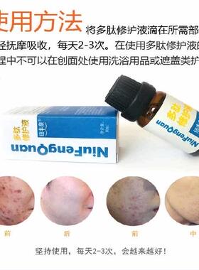 点痣修复液买二送一修复纽丰泉