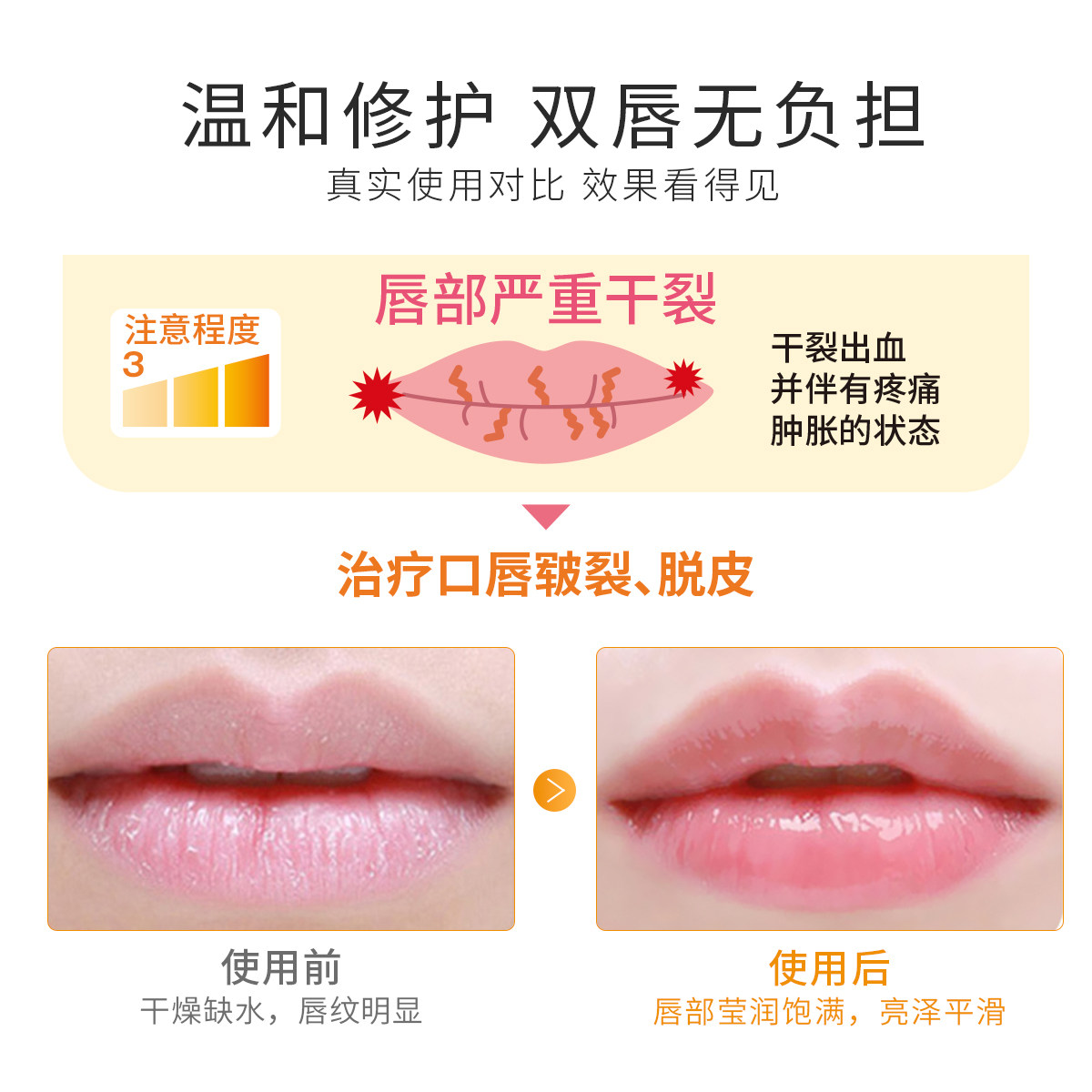 yuskin /悠斯晶维生素修护纹润唇膏 yuskin悠斯晶化妆品润唇膏