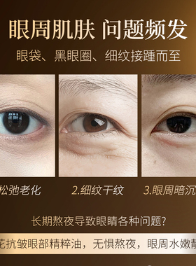 【升级款2.0版】孟栩堂兰花眼部抗皱精粹油兰科植物小果咖啡油CM