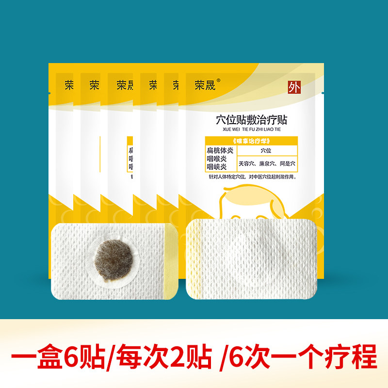 荣晟咽炎贴儿童咽扁贴 荣晟膏药贴（器械）