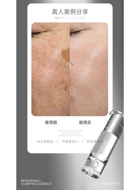 格丽缇光感净肌精华液白肤提亮嫩