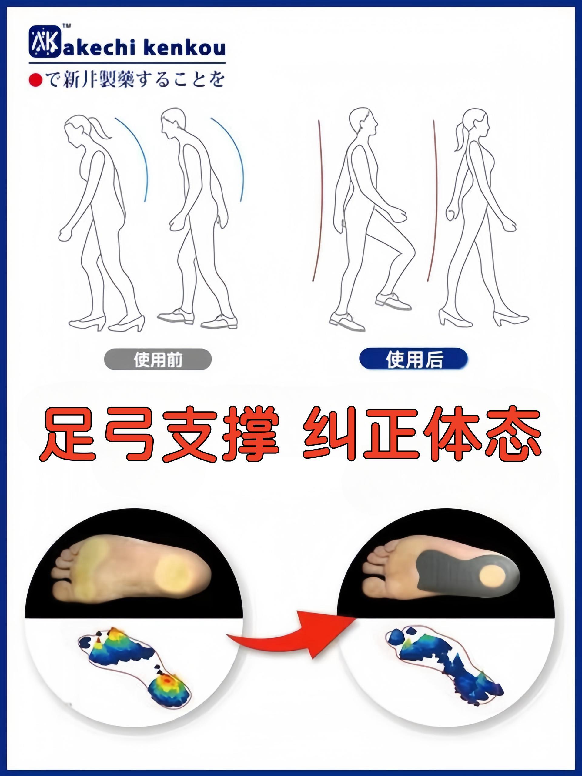 日本akechi kenkou矫正鞋垫平底足塌陷支撑足外翻o型腿神器足弓垫-图2