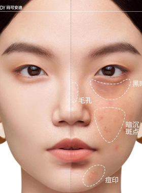 玛可安迪遮瑕液遮盖痘泪沟黑眼圈