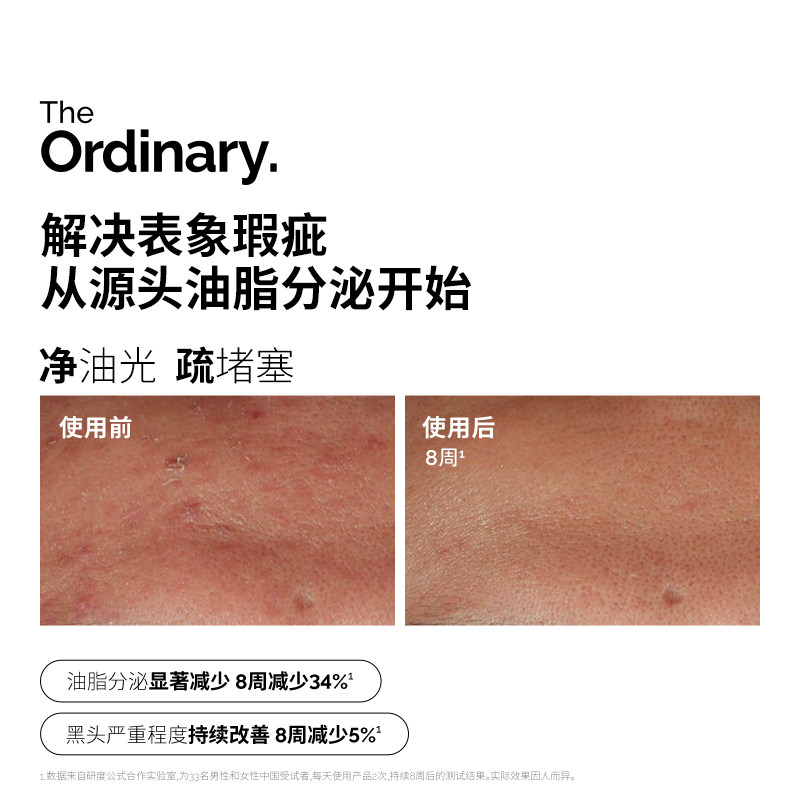 加拿大the ordinary 10%烟酰胺+1%锌焕白精华 控油紧致提亮肤色