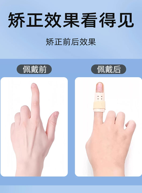 手指骨折固定指套弯曲矫正器