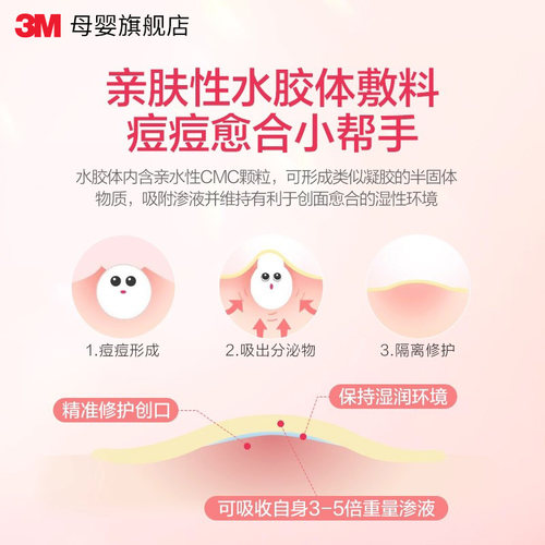3M人工皮痘痘贴隐形修复孕妇去痘贴去粉刺宝妈痘痘贴孕妇成人 - 图1