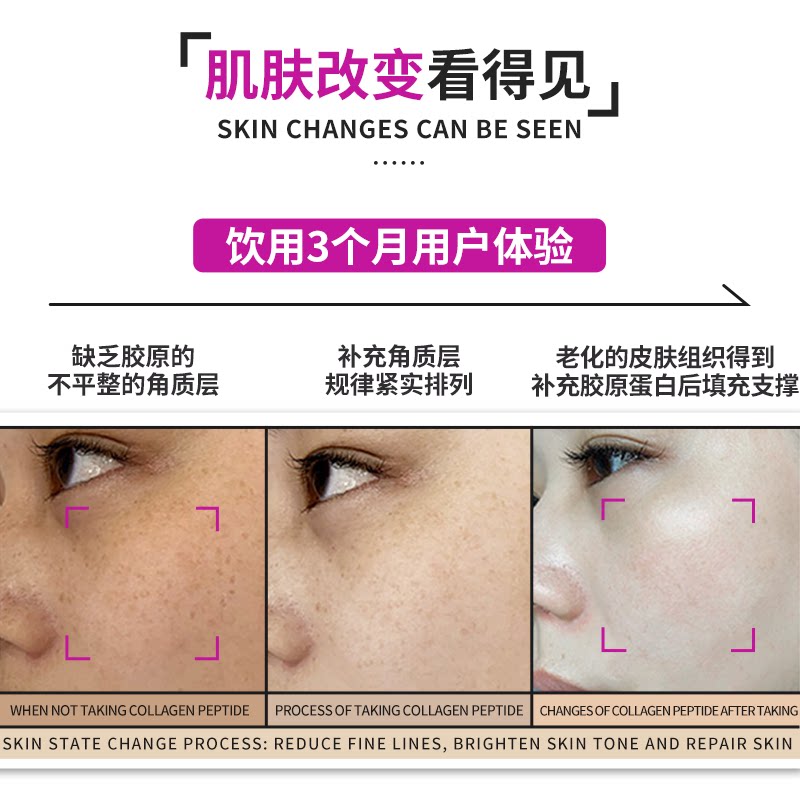 【九盒装】美国进口losoki胶原蛋白肽 HappyValley海外胶原蛋白