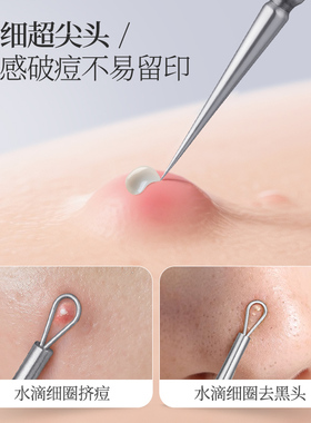 超尖细闭口粉刺针黑头针