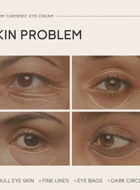 Turmeric Remove Dark Circles Eye Serum Anti-Wrinkle Fade Fin