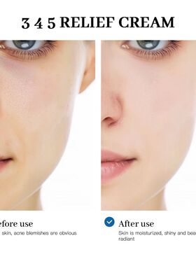 345 Relief Cream Comprehensive solution to skin problems Ant