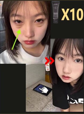 New Anti Wrinkle Eye Cream Remove Eye Bags Puffiness Lifting