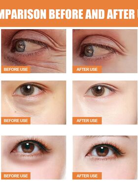 Vitamin C Eye Cream Anti Puffiness Dark Circle Remover Conto