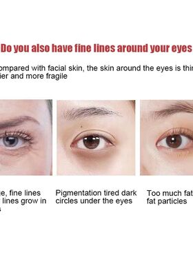 New Anti-Wrinkle Eye Cream Eye Serum Fades Crow's Feet Remov