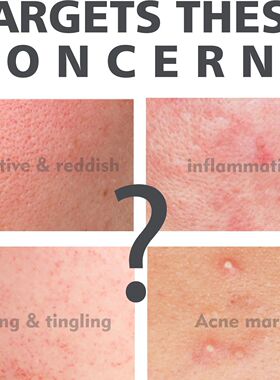 SKIN PERFECTING 2% BHA Liquid Salicylic Acid