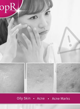 Repair Acne Brightening Serum Acne Scar Spots Cleaning Serum