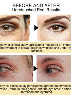 Anti-Wrinkle Eye Cream Dark Circles Remove Eye Bags Puffy Re