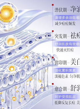 润凰祛痘美白去痘印烟酰胺