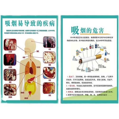 禁烟宣传海报挂图墙贴禁止吸烟戒烟吸烟有害健康宣传画标语牌贴纸 - 图2