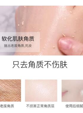 果酸去角质Fruit acid Deep Cleansing Exfoliating Peeling Gel