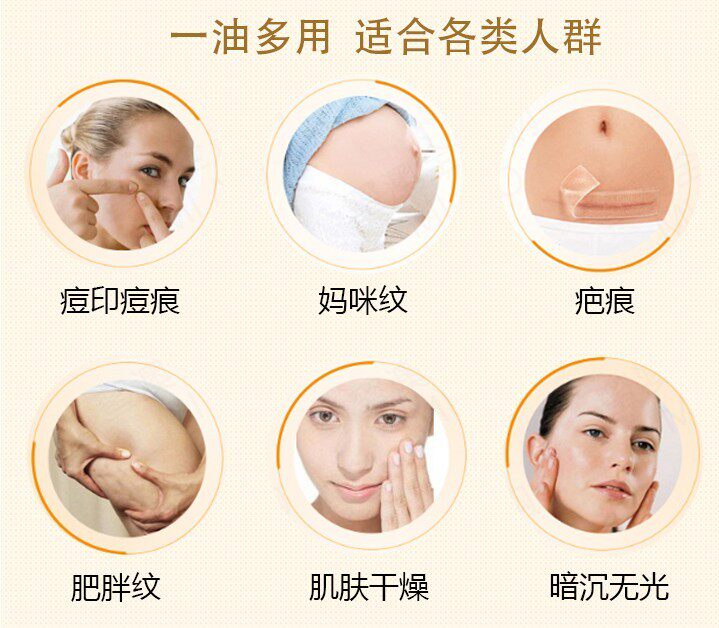 bio oil百洛油200ml预防身体油 mojelekarna海外妊娠纹护理