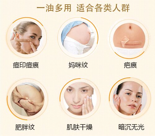 Bio Oil百洛油淡化孕妇纹孕妇专用防护产前后修护多用身体护理油 - 图0