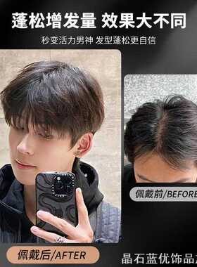 男士真发垫发片贴头顶补发假刘真发片创意真发补发ins风