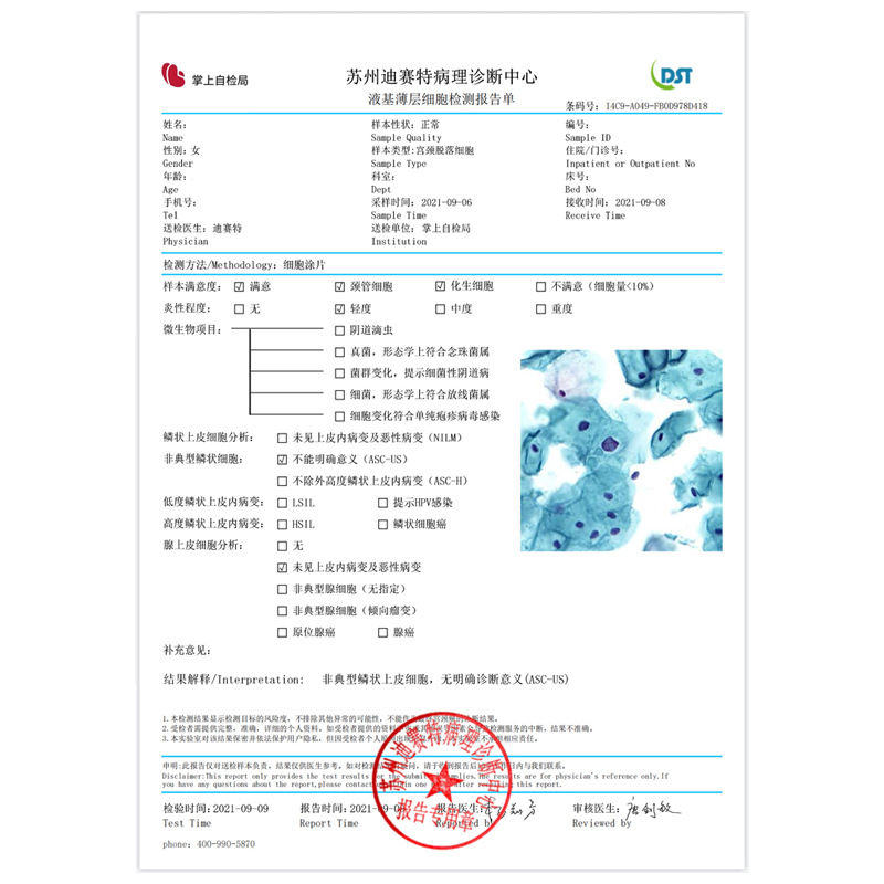 TCT检测宫颈双染检测宫颈DNA甲基化检测居家自检宫颈病变检查 - 图0