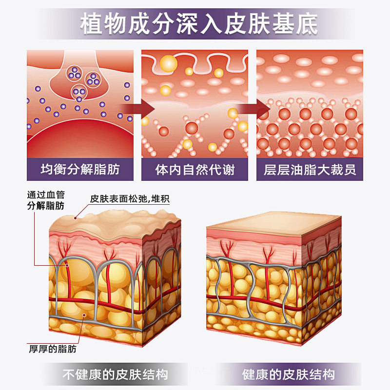 【买一送一】恢复男女好身材懒人贴日本草本能量暖腰清脂贴