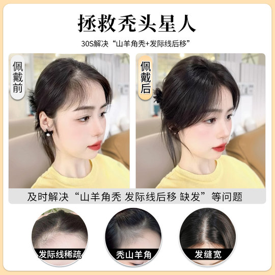 胎毛刘海假发女片头顶遮秃顶神器高颅顶蓬松真发无痕发际线假发贴
