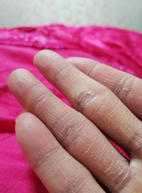 西京维生素E乳霜护手霜润肤身体乳手干裂起麟皮屑保湿干燥认西京