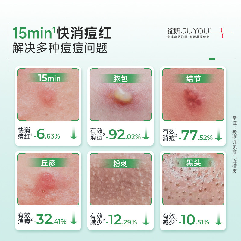 【天猫U先】绽妍祛痘绿面膜2片修屏障油痘肌控油收缩毛孔水油平衡,淘宝优惠券,粉丝福利购,淘宝优惠卷