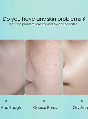 10pcs Hyaluronic Acid Hydrating Facial Mask Sheet Masks for