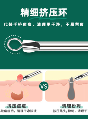 粉刺针挤压棒刮黑头豆豆去痘痘带