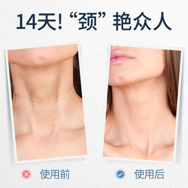 BellaB海外旗舰店小蜜蜂颈霜劲部护理颈膜嫩白提拉紧致颈纹霜去淡化颈纹神器2支装0