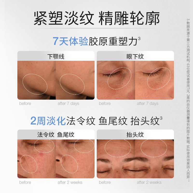 德美乐嘉胶原银行精华30ml抗老抗皱紧致充盈面部精华Dermalogica