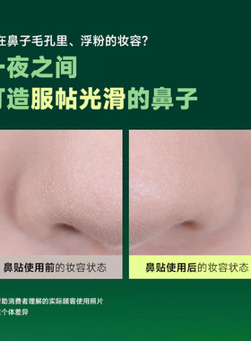careplus去黑头睡眠鼻贴溶解油脂