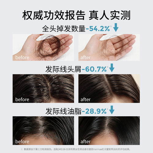 Hairmax红光健发带束发带发箍发际线头发毛发护理仪健发小光环 - 图1