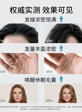 Hairmax9束红光生发梳