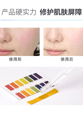 玻尿酸修护冻干粉深层精华液皮肤
