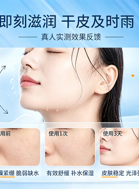 JM维C玻尿酸补水舒缓喷雾