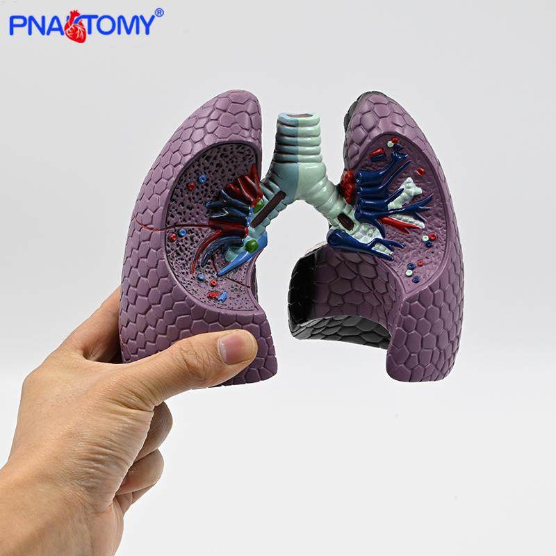 人体肺模型 吸烟病变肺 呼吸科标本健康肺胸外科肺部解剖健康教学 - 图1