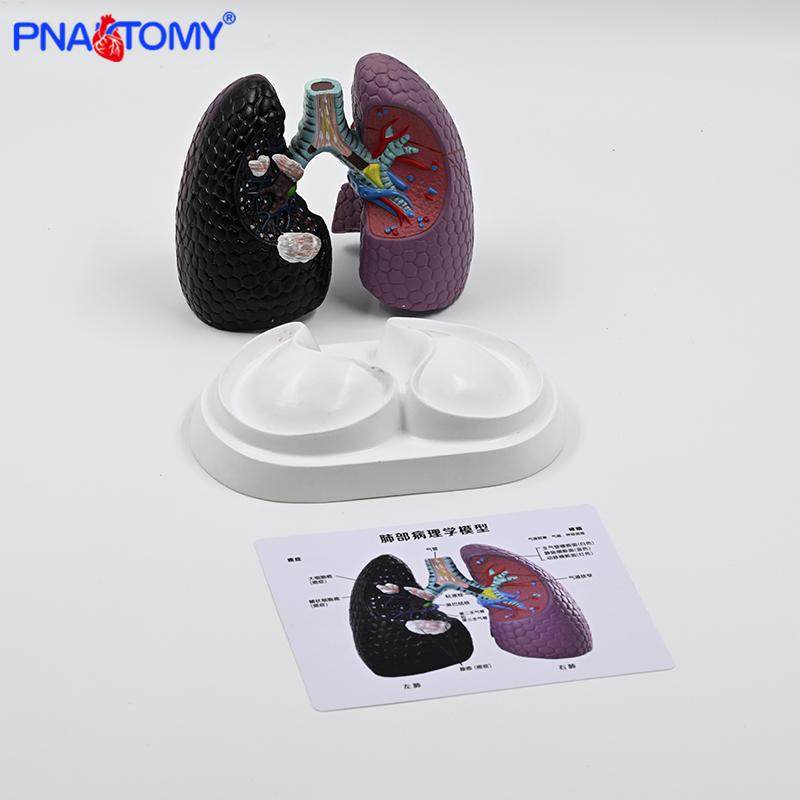 人体肺模型 吸烟病变肺 呼吸科标本健康肺胸外科肺部解剖健康教学 - 图2