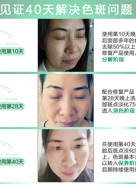 拍3瓶发4瓶一品莲15ML祛斑精华液